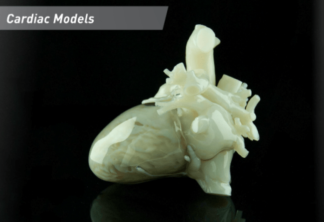 Model anatomiczny serca - druk 3D [7]