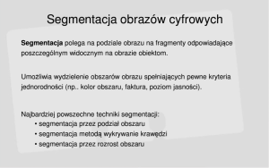 910552095_Segmentacjaobrazu.thumb.png.016345a87dce4ae44c8735e11f7cbf35.png